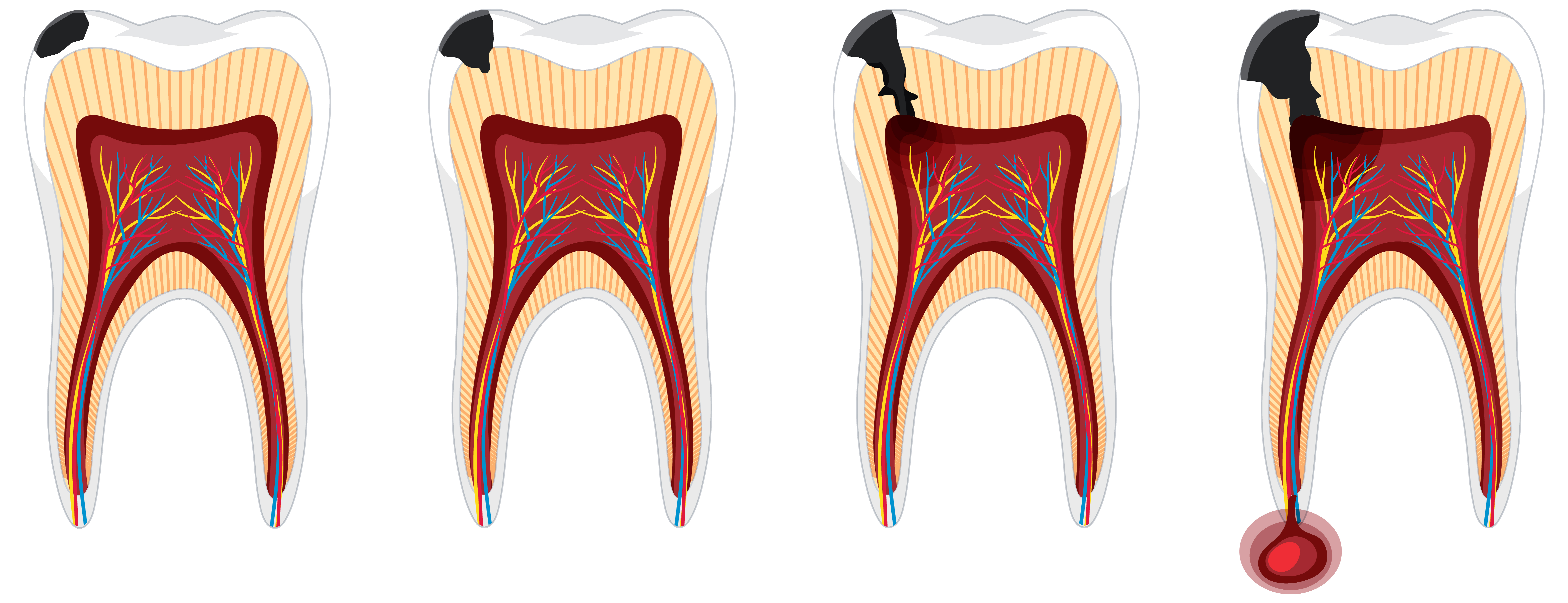 Periodontal Services