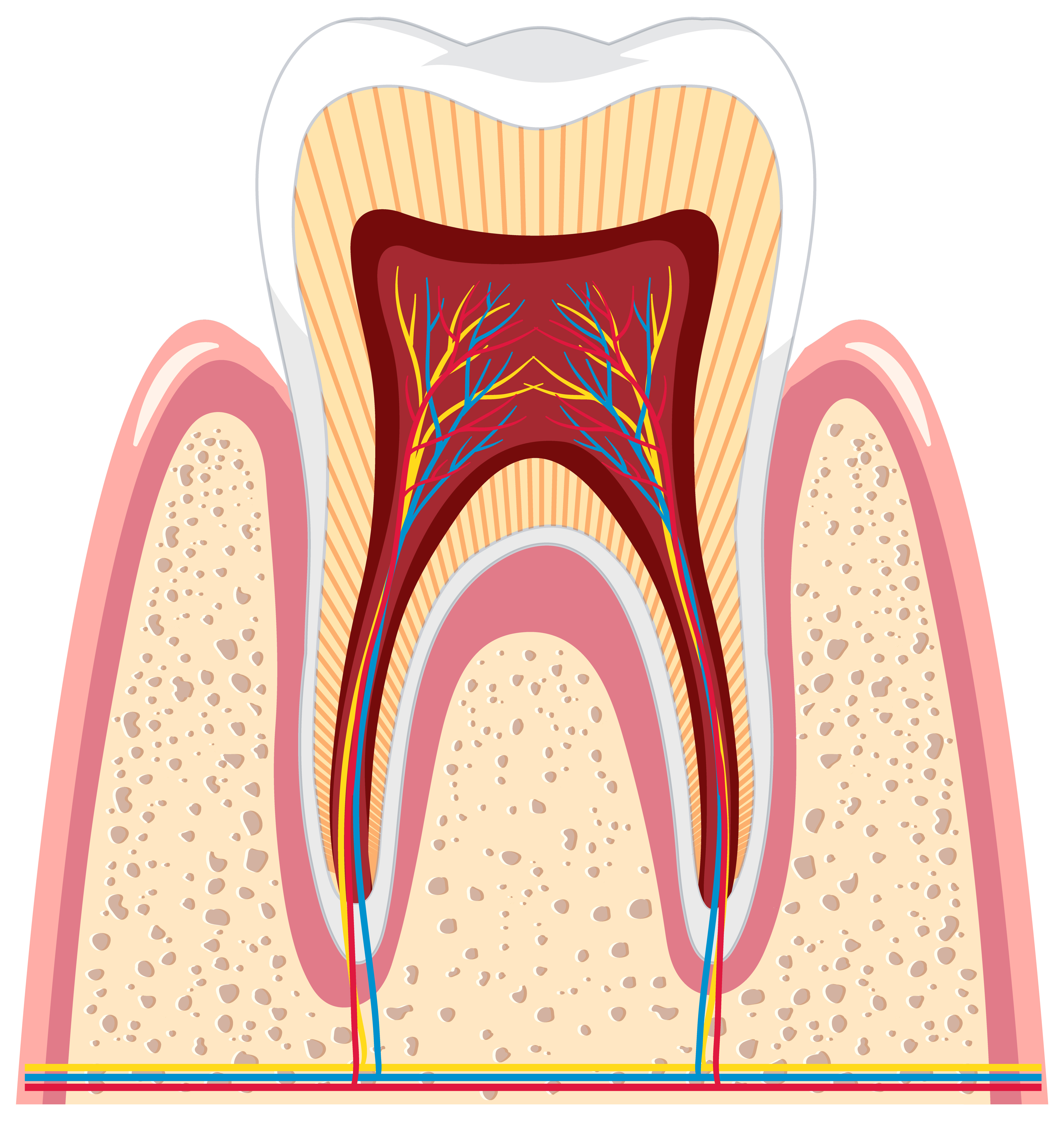 Root Canal Therapy